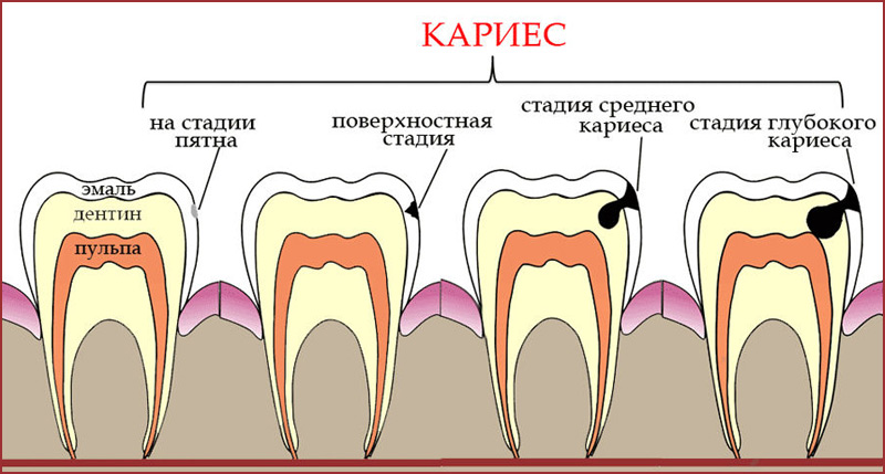 ohe907pzhcqlspu3qsc42qo26x3f8tf3.jpg ohe907pzhcqlspu3qsc42qo26x3f8tf3.jpg