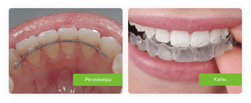 reteynery.png reteynery.png