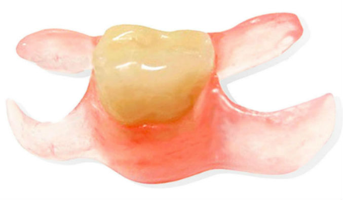 иммедиат-протез.jpg иммедиат-протез.jpg