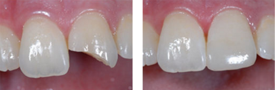 vost-x-e86-2.png vost-x-e86-2.png