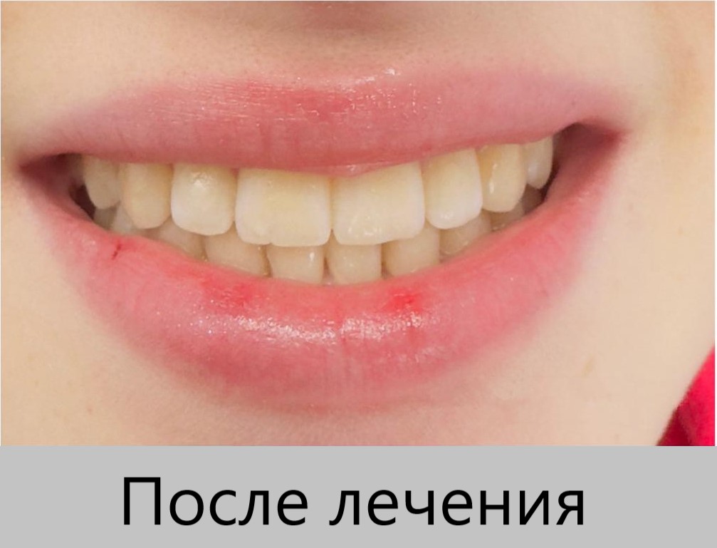 babbe517-a5e7-4781-9f41-f58b10b5c629 (1).jpg babbe517-a5e7-4781-9f41-f58b10b5c629 (1).jpg