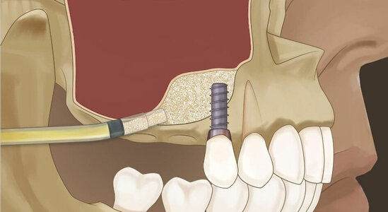 M_height.jpg M_height.jpg